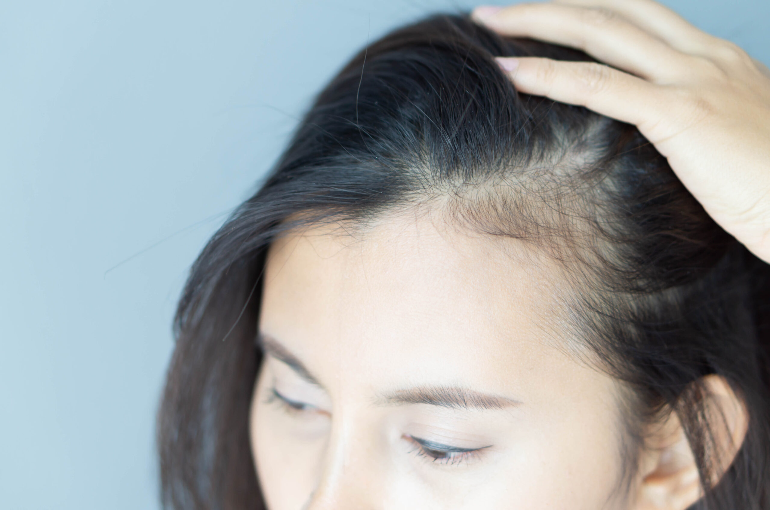 how to limit postpartum hair loss